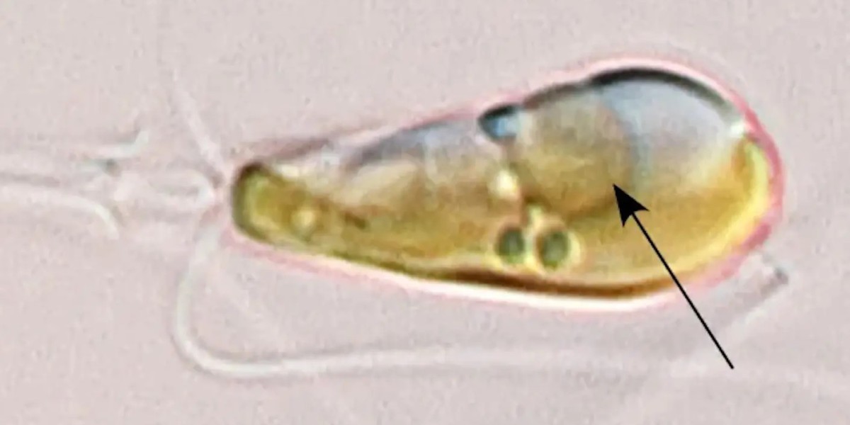 重磅! 发现第一种可以固氮的真核生物