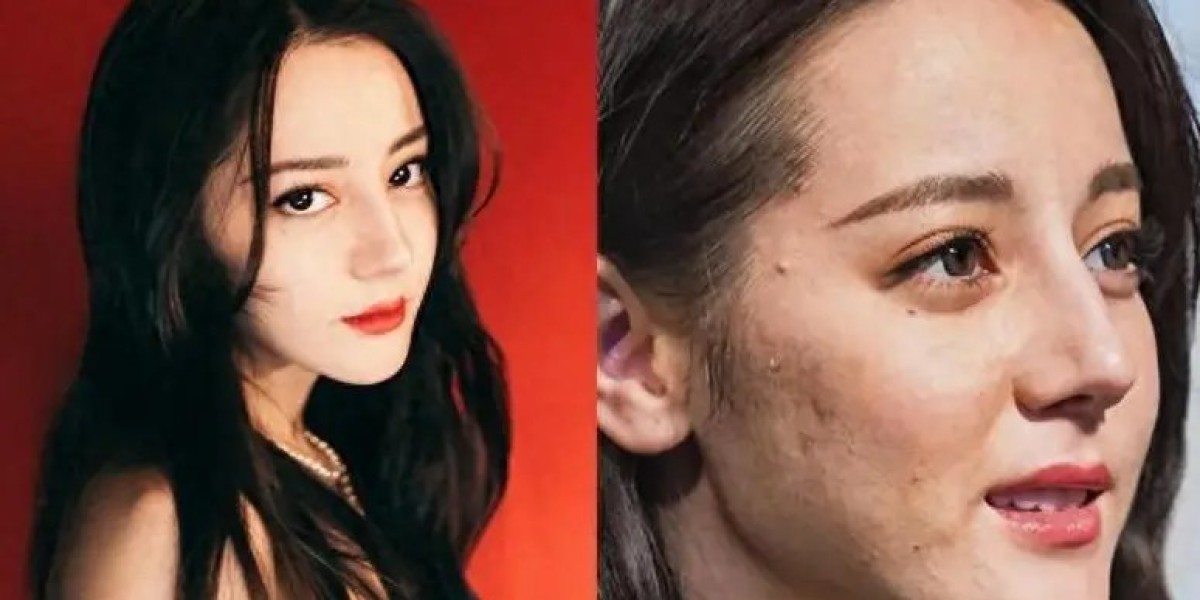 女星去掉滤镜，刘亦菲牙黄、赵丽颖瞬间老10岁 张柏芝“丑”到认不出